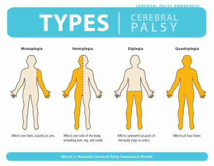 types of cerebral palsy infographic
